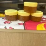كريم الحروق والجروح
